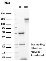 SDS-PAGE analysis of purified, BSA-free IL15 antibody (clone rIL15/8050) as confirmation of integrity and purity.