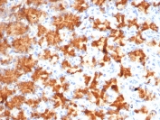 IHC staining of FFPE human stomach tissue with Interleukin-2 antibody (clone IL2/4986). HIER: boil tissue sections in pH 9 10mM Tris with 1mM EDTA for 20 min and allow to cool before testing.