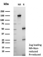 SDS-PAGE analysis of purified, BSA-free Interleukin-2 (IL-2) antibody (clone IL2/7359) as confirmation of integrity and purity.