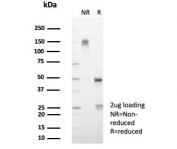 SDS-PAGE analysis of purified, BSA-free Interleukin-15 antibody (clone IL15/4696) as confirmation of integrity and purity.