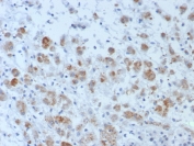 IHC staining of FFPE human adrenal gland tissue with Interleukin-15 antibody (clone IL15/4696). HIER: boil tissue sections in pH 9 10mM Tris with 1mM EDTA for 20 min and allow to cool before testing.