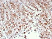 IHC staining of FFPE human adrenal gland tissue with Interleukin-15 antibody (clone IL15/4699). HIER: boil tissue sections in pH 9 10mM Tris with 1mM EDTA for 20 min and allow to cool before testing.