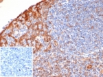 IHC staining of FFPE human tonsil tissue with STING antibody (clone STING1/7436). Inset: PBS used in place of primary Ab (secondary Ab negative control). HIER: boil tissue sections in pH 9 10mM Tris with 1mM EDTA for 20 min and allow to cool before testing.