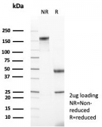 SDS-PAGE analysis of purified, BSA-free Mineralocorticoid Receptor antibody (clone NR3C2/4900) as confirmation of integrity and purity.