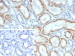 IHC staining of FFPE human kidney tissue with Mineralocorticoid Receptor antibody (clone NR3C2/4900). Inset: PBS used in place of primary Ab (secondary Ab negative control). HIER: boil tissue sections in pH 9 10mM Tris with 1mM EDTA for 20 min and allow to cool before testing.