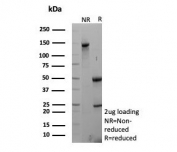SDS-PAGE analysis of purified, BSA-free Cadherin 6 antibody (clone CDH6/3191) as confirmation of integrity and purity.