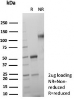 SDS-PAGE analysis of purified, BSA-free SDHA antibody (clone SDHA/7491) as confirmation of integrity and purity.