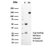 SDS-PAGE analysis of purified, BSA-free SDHA antibody (clone SDHA/7493) as confirmation of integrity and purity.