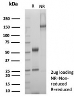 SDS-PAGE analysis of purified, BSA-free SDHA antibody (clone SDHA/7495) as confirmation of integrity and purity.