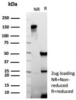 SDS-PAGE analysis of purified, BSA-free OCLN antibody (clone rOCLN/8525) as confirmation of integrity and purity.