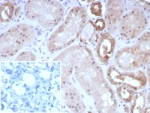 IHC staining of FFPE human kidney tissue with OCLN antibody (clone rOCLN/8525). Inset: PBS used in place of primary Ab (secondary Ab negative control). HIER: boil tissue sections in pH 9 10mM Tris with 1mM EDTA for 20 min and allow to cool before testing.