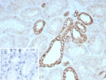 IHC staining of FFPE human kidney tissue with OCLN antibody (clone rOCLN/8776). Inset: PBS used in place of primary Ab (secondary Ab negative control). HIER: boil tissue sections in pH 9 10mM Tris with 1mM EDTA for 20 min and allow to cool before testing.