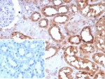 IHC staining of FFPE human kidney tissue with Occludin antibody (clone OCLN/8526R). Inset: PBS used in place of primary Ab (secondary Ab negative control). HIER: boil tissue sections in pH 9 10mM Tris with 1mM EDTA for 20 min and allow to cool before testing.