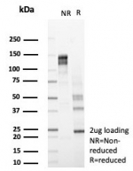 SDS-PAGE analysis of purified, BSA-free Hexosaminidase B antibody (clone HEXB/7762) as confirmation of integrity and purity.