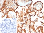 IHC staining of FFPE human placental tissue with Hexosaminidase B antibody (clone HEXB/7762). Inset: PBS used in place of primary Ab (secondary Ab negative control). HIER: boil tissue sections in pH 9 10mM Tris with 1mM EDTA for 20 min and allow to cool before testing.