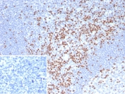 IHC staining of FFPE human tonsil tissue with TCF7 antibody (clone TCF7/7631). Inset: PBS used in place of primary Ab (secondary Ab negative control). HIER: boil tissue sections in pH 9 10mM Tris with 1mM EDTA for 20 min and allow to cool before testing.