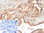 IHC staining of FFPE human placental tissue with Vascular Endothelial Growth Factor antibody (clone VEGFA/7758R). Inset: PBS used in place of primary Ab (secondary Ab negative control). HIER: boil tissue sections in pH 9 10mM Tris with 1mM EDTA for 20 min and allow to cool before testing.
