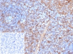 IHC staining of FFPE human tonsil tissue with STING1 antibody (clone STING1/7437). Inset: PBS used in place of primary Ab (secondary Ab negative control). HIER: boil tissue sections in pH 9 10mM Tris with 1mM EDTA for 20 min and allow to cool before testing.