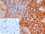 IHC staining of FFPE human tonsil tissue with STING1 antibody (clone STING1/7439). Inset: PBS used in place of primary Ab (secondary Ab negative control). HIER: boil tissue sections in pH 9 10mM Tris with 1mM EDTA for 20 min and allow to cool before testing.