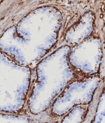 IHC staining of FFPE human prostate tissue with STING1 antibody (clone STING1/7439). HIER: boil tissue sections in pH 9 10mM Tris with 1mM EDTA for 20 min and allow to cool before testing.