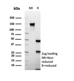 SDS-PAGE analysis of purified, BSA-free CD74 antibody (clone CLIP/7945) as confirmation of integrity and purity.