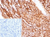 IHC staining of FFPE human tonsil tissue with CD74 antibody (clone CLIP/7945) at 2ug/ml. Inset: PBS used in place of primary Ab (secondary Ab negative control). HIER: boil tissue sections in pH 9 10mM Tris with 1mM EDTA for 20 min and allow to cool before testing.