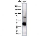 Western blot testing of human Raji cell lysate with CD74 antibody (clone CLIP/7194). Expected molecular weight: 33-43 kDa.