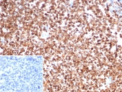IHC staining of FFPE human spleen tissue with CD74 antibody (clone CLIP/7194) at 2ug/ml. Inset: PBS used in place of primary Ab (secondary Ab negative control). HIER: boil tissue sections in pH 9 10mM Tris with 1mM EDTA for 20 min and allow to cool before testing.