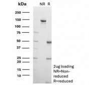 SDS-PAGE analysis of purified, BSA-free CD74 antibody (clone CLIP/7946) as confirmation of integrity and purity.