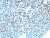IHC staining of FFPE human tonsil tissue with CD74 antibody (clone CLIP/7946) at 2ug/ml. HIER: boil tissue sections in pH 9 10mM Tris with 1mM EDTA for 20 min and allow to cool before testing.