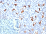 IHC staining of FFPE human tonsil tissue with SPARC / Osteonectin antibody (clone OSTN/3756). Inset: PBS used in place of primary Ab (secondary Ab negative control). HIER: boil tissue sections in pH 9 10mM Tris with 1mM EDTA for 20 min and allow to cool before testing.