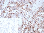 IHC staining of FFPE human spleen tissue with Osteonectin antibody (clone rOSTN/8527). Inset: PBS used in place of primary Ab (secondary Ab negative control). HIER: boil tissue sections in pH 9 10mM Tris with 1mM EDTA for 20 min and allow to cool before testing.