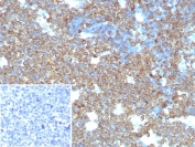 IHC staining of FFPE human tonsil tissue with CD74 antibody (clone CLIP/8680R). Inset: PBS used in place of primary Ab (secondary Ab negative control). HIER: boil tissue sections in pH 9 10mM Tris with 1mM EDTA for 20 min and allow to cool before testing.