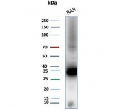 Western blot testing of human Raji cell lysate with CD74 antibody (clone CLIP/8680R). Expected molecular weight: 33-43 kDa.