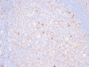 IHC staining of FFPE human tonsil tissue with TIM3 antibody (clone TIM3/6863R). HIER: boil tissue sections in pH 9 10mM Tris with 1mM EDTA for 20 min and allow to cool before testing.