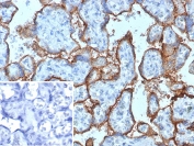 IHC staining of FFPE human placental tissue with CD168 / HMMR antibody (clone HMMR/8021). Inset: PBS used in place of primary Ab (secondary Ab negative control). HIER: boil tissue sections in pH 9 10mM Tris with 1mM EDTA for 20 min and allow to cool before testing.