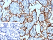IHC staining of FFPE human placental tissue with CD168 / HMMR antibody (clone HMMR/8021). Inset: PBS used in place of primary Ab (secondary Ab negative control). HIER: boil tissue sections in pH 9 10mM Tris with 1mM EDTA for 20 min and allow to cool before testing.