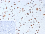 IHC staining of FFPE human brain tissue with NPM1 antibody (clone rNPM1/8056). Inset: PBS used in place of primary Ab (secondary Ab negative control). HIER: boil tissue sections in pH 9 10mM Tris with 1mM EDTA for 20 min and allow to cool before testing.