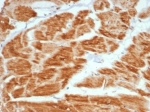 IHC staining of FFPE human heart tissue with VEGF antibody (clone VEGFA/7635R). HIER: boil tissue sections in pH 9 10mM Tris with 1mM EDTA for 20 min and allow to cool before testing.
