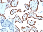 IHC staining of FFPE human placental tissue with VEGF antibody (clone VEGFA/7635R). Inset: PBS used in place of primary Ab (secondary Ab negative control). HIER: boil tissue sections in pH 9 10mM Tris with 1mM EDTA for 20 min and allow to cool before testing.