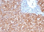 IHC staining of FFPE human liver tissue with VEGF antibody (clone VEGFA/7636R). HIER: boil tissue sections in pH 9 10mM Tris with 1mM EDTA for 20 min and allow to cool before testing.