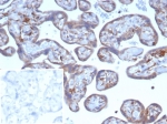 IHC staining of FFPE human placental tissue with VEGF antibody (clone VEGFA/7636R). Inset: PBS used in place of primary Ab (secondary Ab negative control). HIER: boil tissue sections in pH 9 10mM Tris with 1mM EDTA for 20 min and allow to cool before testing.