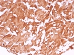 IHC staining of FFPE human heart tissue with VEGF antibody (clone VEGFA/7636R). HIER: boil tissue sections in pH 9 10mM Tris with 1mM EDTA for 20 min and allow to cool before testing.