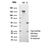 SDS-PAGE analysis of purified, BSA-free HSPA1B antibody (clone HSPA1B/7623) as confirmation of integrity and purity.