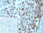 IHC staining of FFPE human tonsil tissue with MCM3 antibody (clone MCM3/3221). Inset: PBS instead of primary antibody, secondary only control.