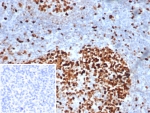 IHC staining of FFPE human tonsil tissue with MCM3 antibody (clone MCM3/6706). Inset: PBS instead of primary antibody, secondary only control.