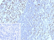 IHC staining of FFPE human tonsil tissue with MCM3 antibody (clone MCM3/8972R). Inset: PBS used in place of primary Ab (secondary Ab negative control). HIER: boil tissue sections in pH 9 10mM Tris with 1mM EDTA for 20 min and allow to cool before testing.
