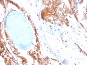 IHC staining of FFPE human prostate tissue with HSP90 beta antibody (clone HSP90AB1/3955). HIER: boil tissue sections in pH 9 10mM Tris with 1mM EDTA for 20 min and allow to cool before testing.