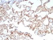IHC staining of FFPE dog lung with HSP90 beta antibody (clone HSP90AB1/3955). HIER: boil tissue sections in pH 9 10mM Tris with 1mM EDTA for 20 min and allow to cool before testing.