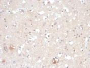 IHC staining of FFPE horse brain with HSP90 beta antibody (clone HSP90AB1/3955). HIER: boil tissue sections in pH 9 10mM Tris with 1mM EDTA for 20 min and allow to cool before testing.
